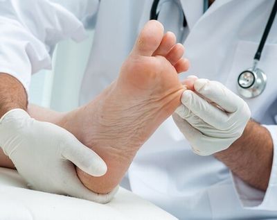 See Your Podiatrist for Callus Removal — Podiatry Group of