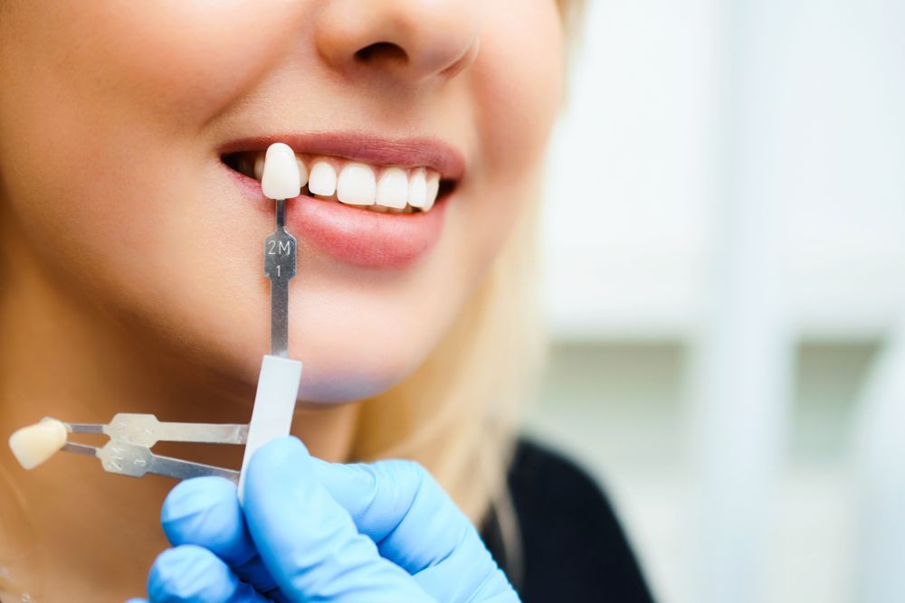 Dentist Comparing Tooth Shade To Patient's Teeth With A Color Guide In A Dental Office