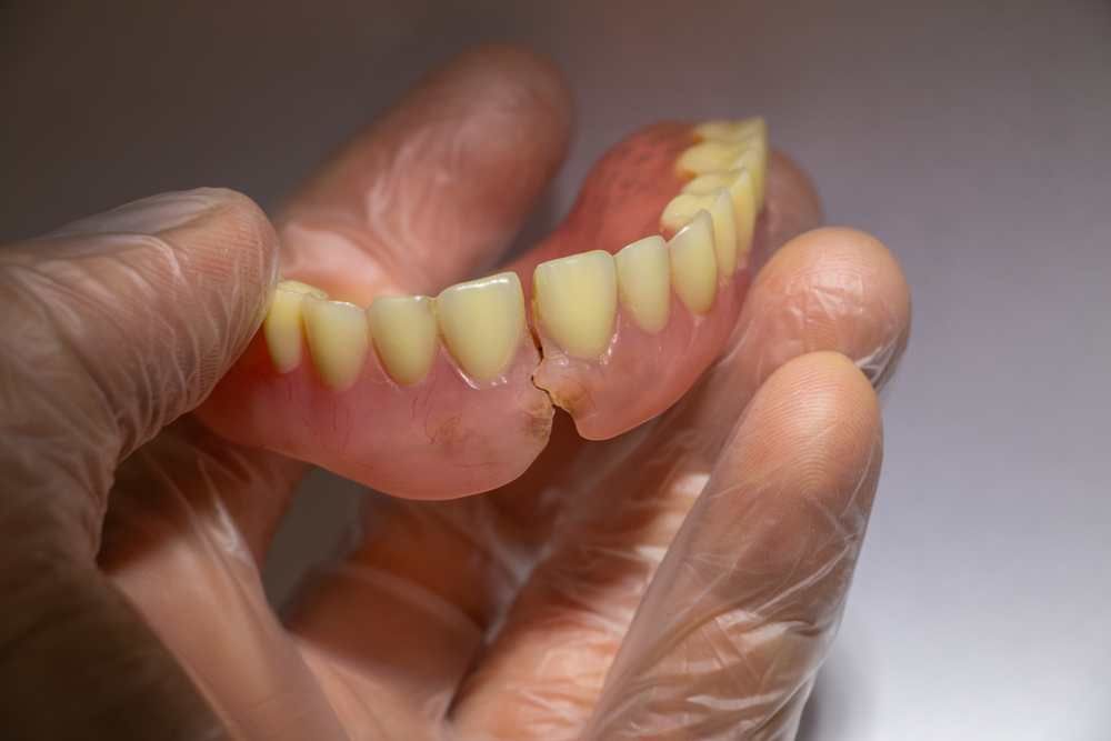 A Person is Holding a Broken Denture in Their Hand — Cairns Precision Dental Group In Woree, QLD
