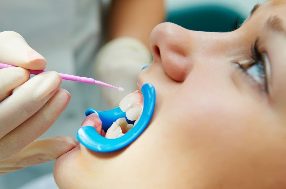 A Woman is Getting Her Teeth Examined by a Dentist — Cairns Precision Dental Group In Woree, QLD