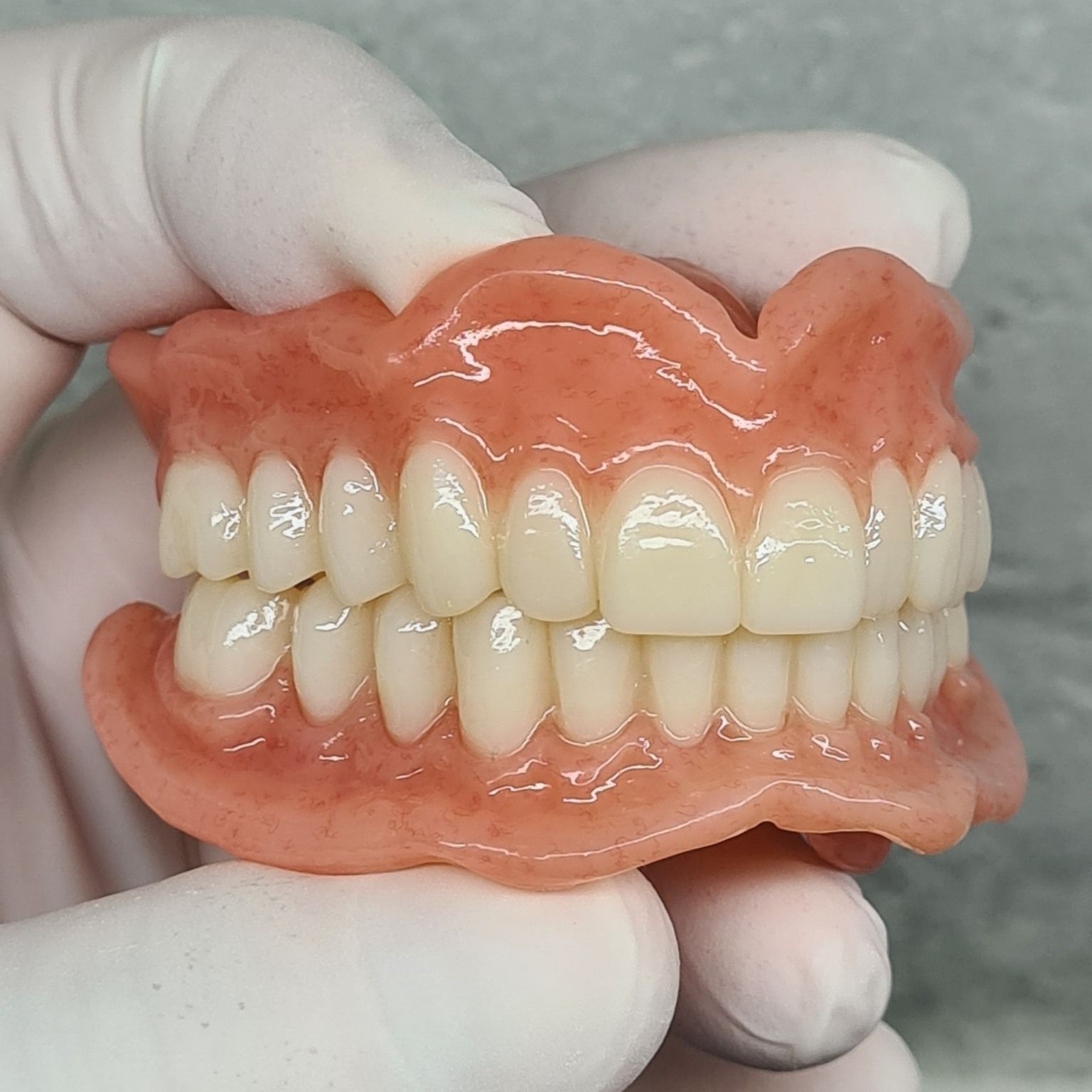 A Person is Holding a Full Denture in Their Hand — Cairns Precision Dental Group In Woree, QLD