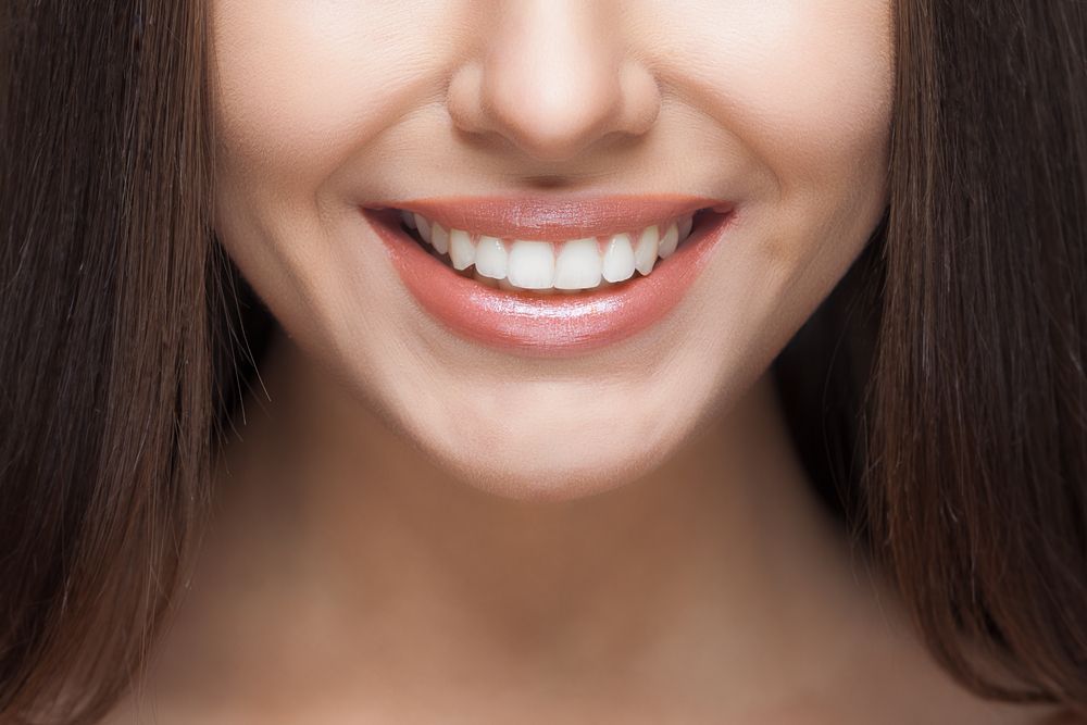 A Close Up of a Woman's Smile With White Teeth — Cairns Precision Dental Group In Woree, QLD