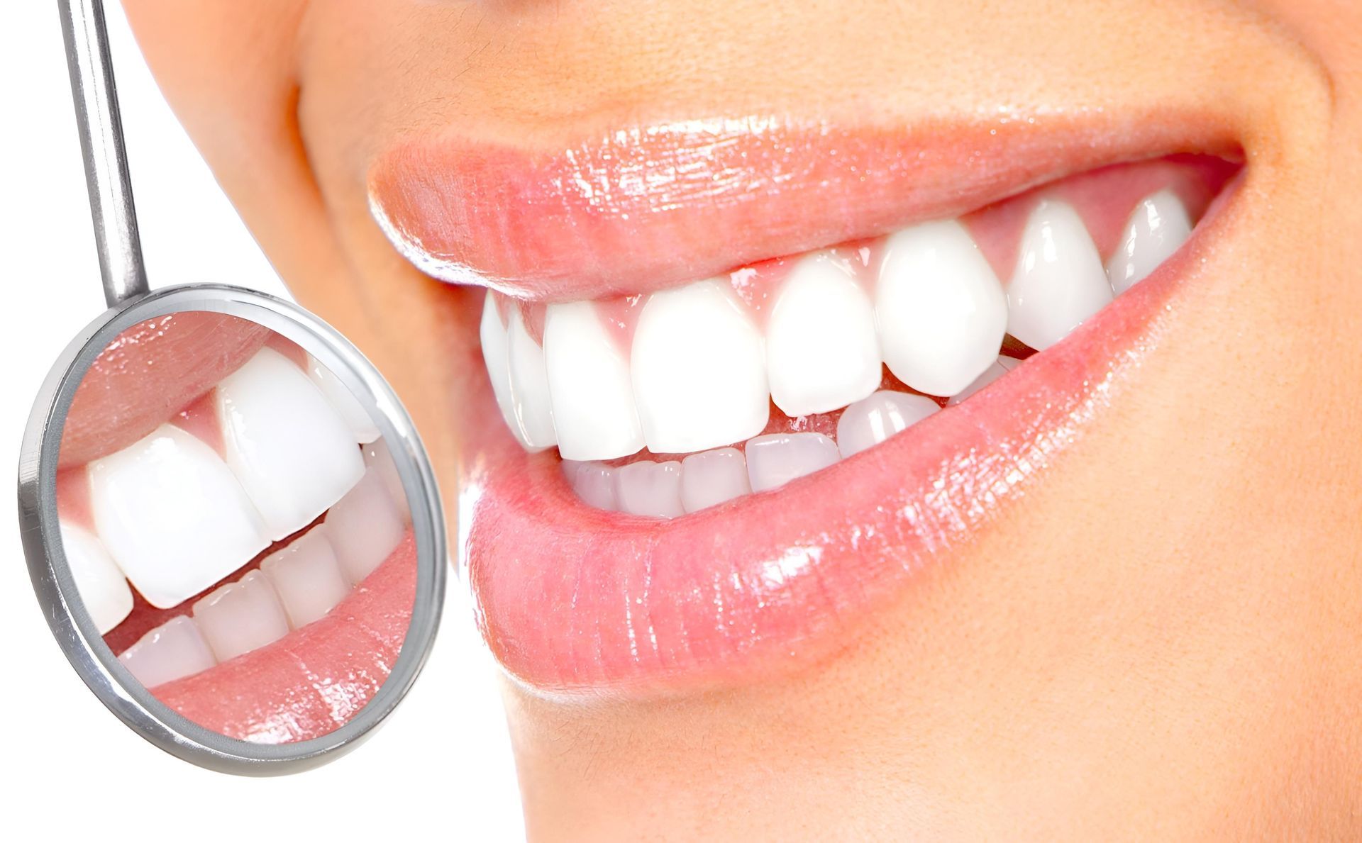 White Teeth