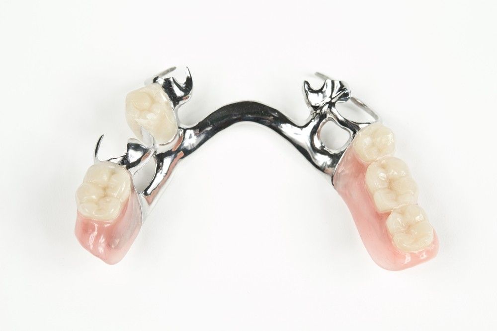 A Close Up of a Metal Denture With Teeth on a White Background — Cairns Precision Dental Group In Woree, QLD