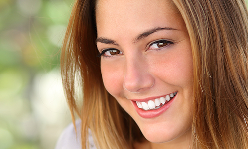 Tooth coloured fillings