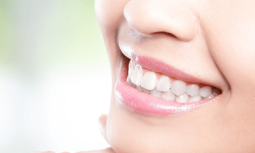 Dental hygiene solutions