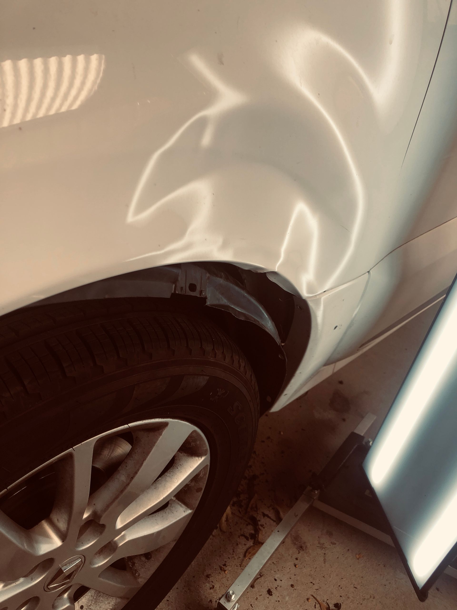 White car fender with a large dent above the tire.