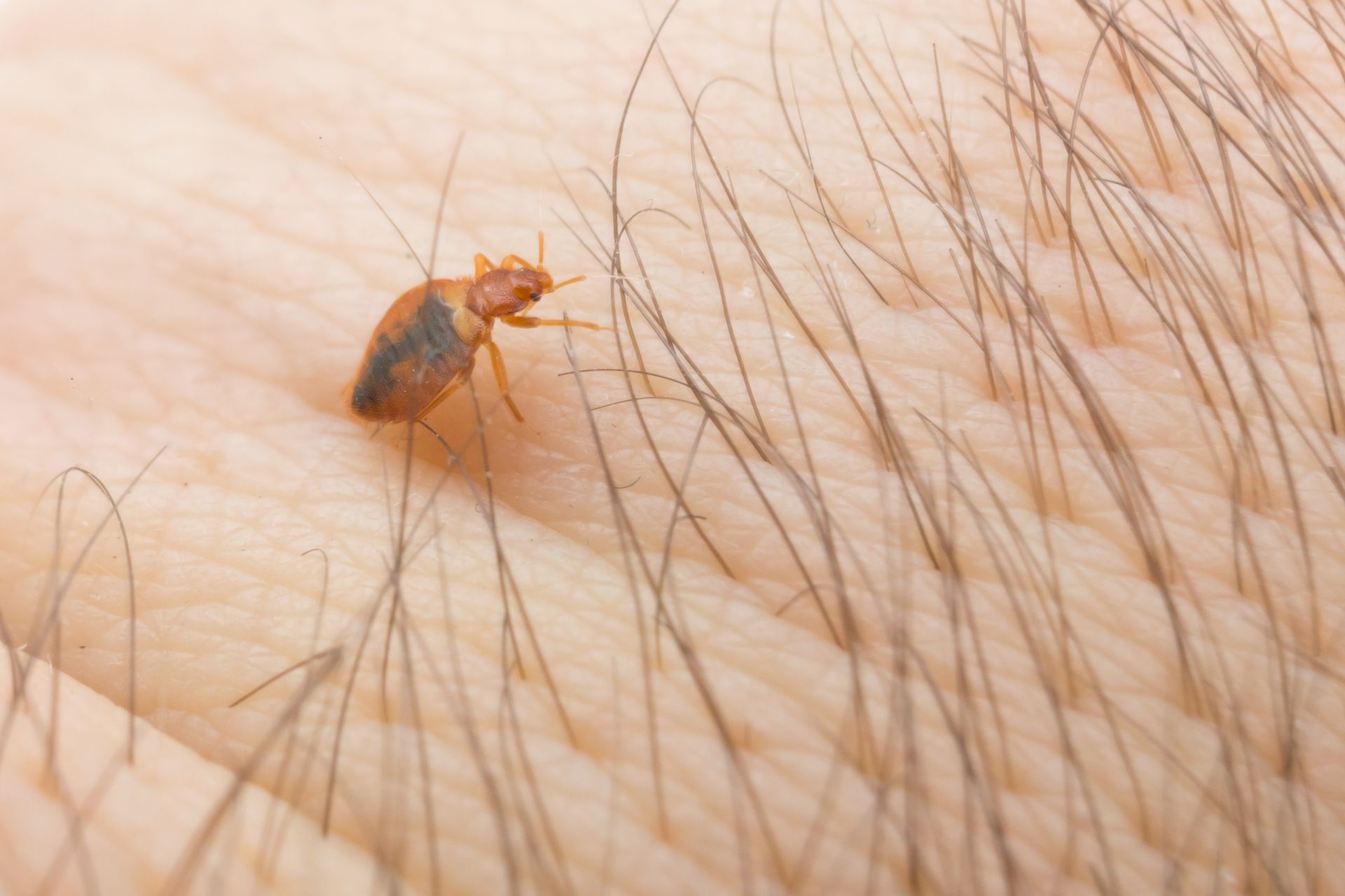 Bed bug crawling on a human hand with dark hairs.