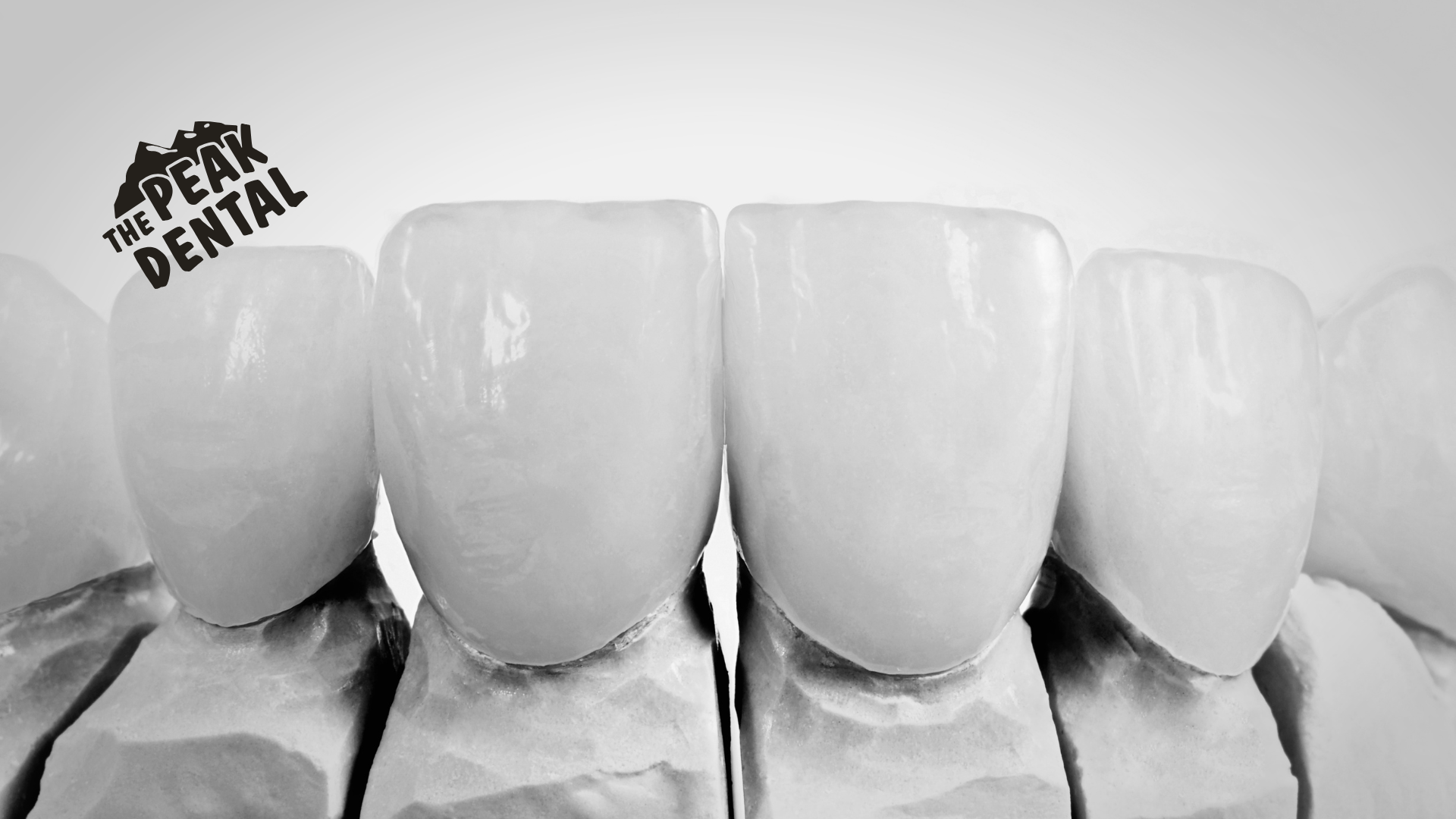 A black and white photo of a model of a person 's teeth.