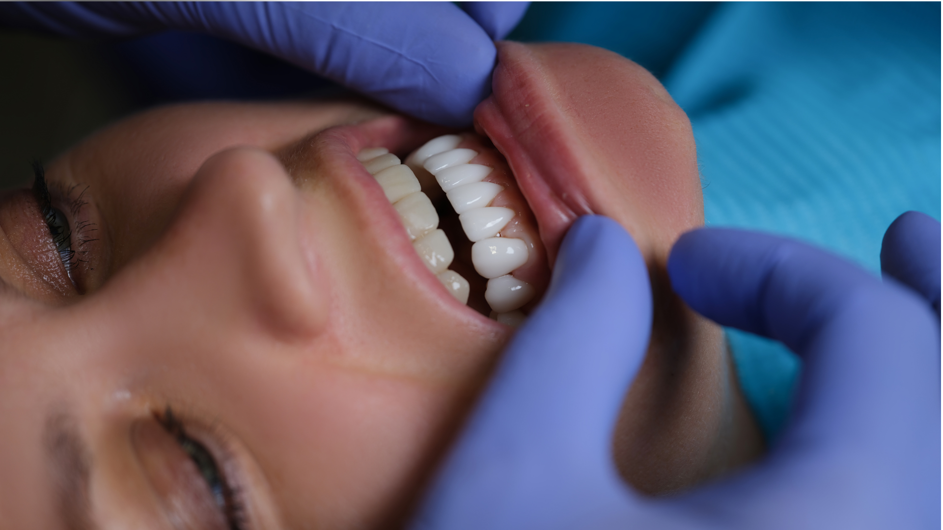 A woman is getting her teeth examined by a dentist.