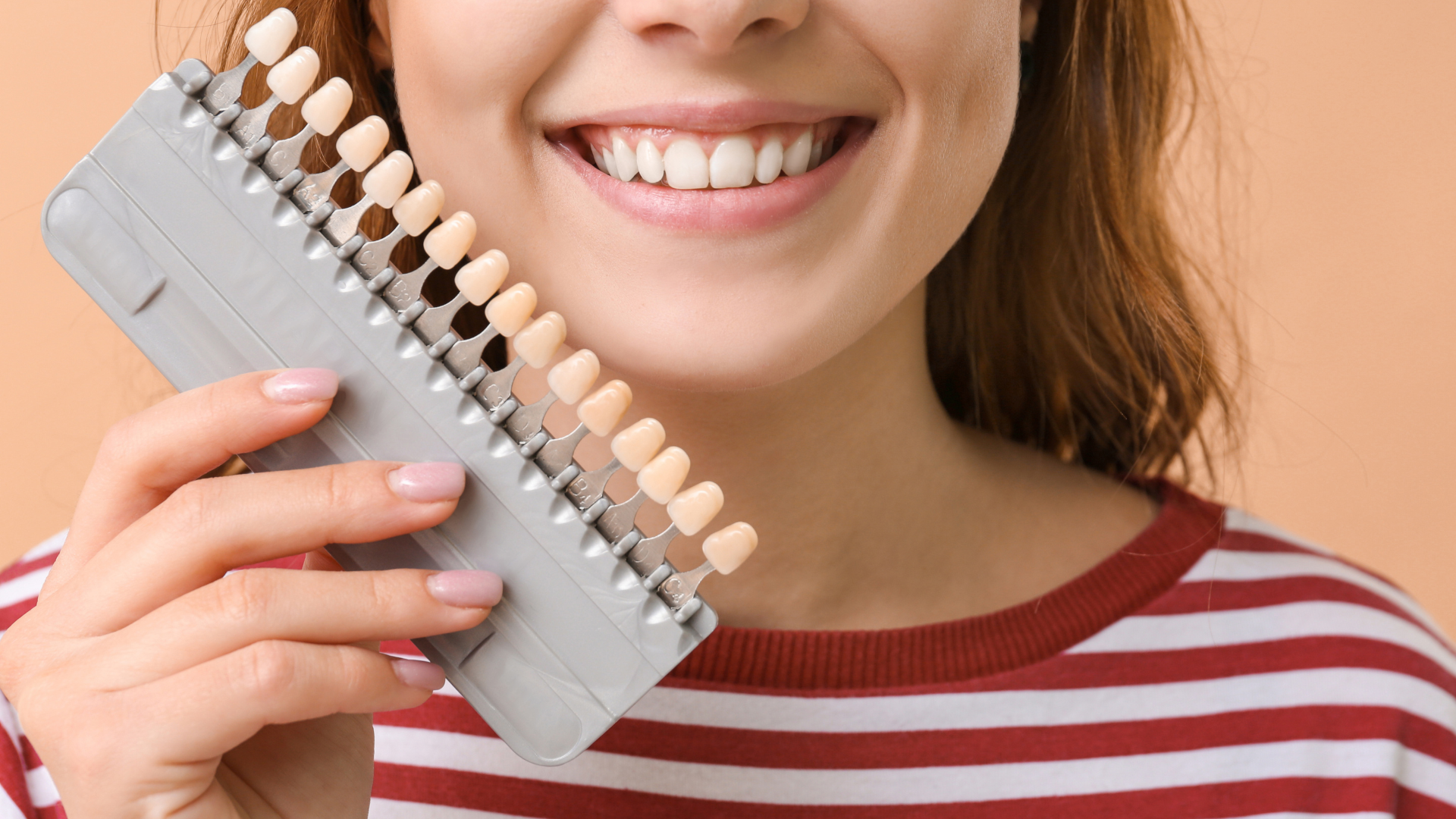 Benefits of Porcelain Veneers