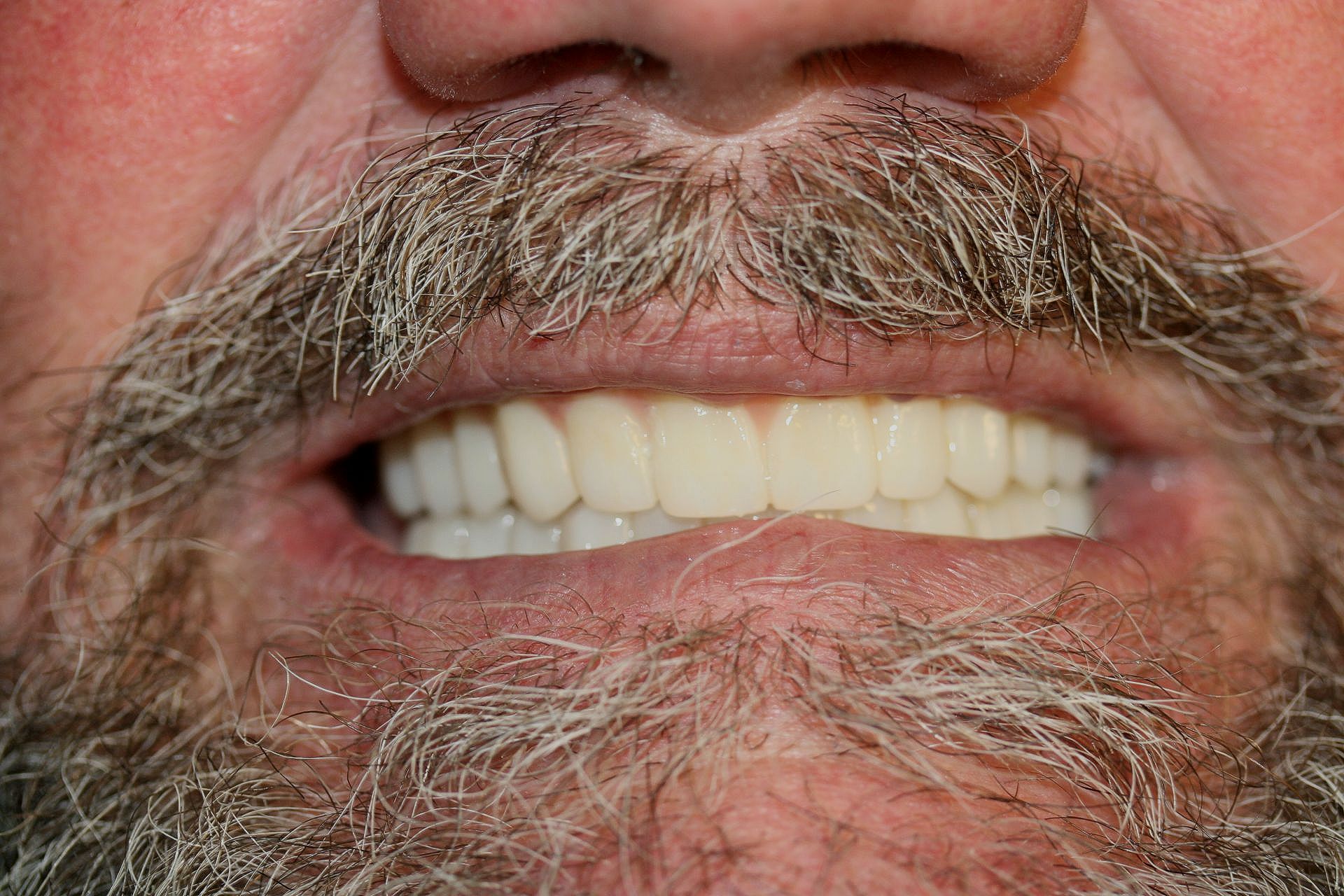 a man with a beard and mustache is smiling with his teeth showing .