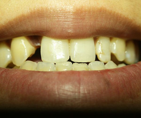 a close up of a person 's mouth showing their teeth