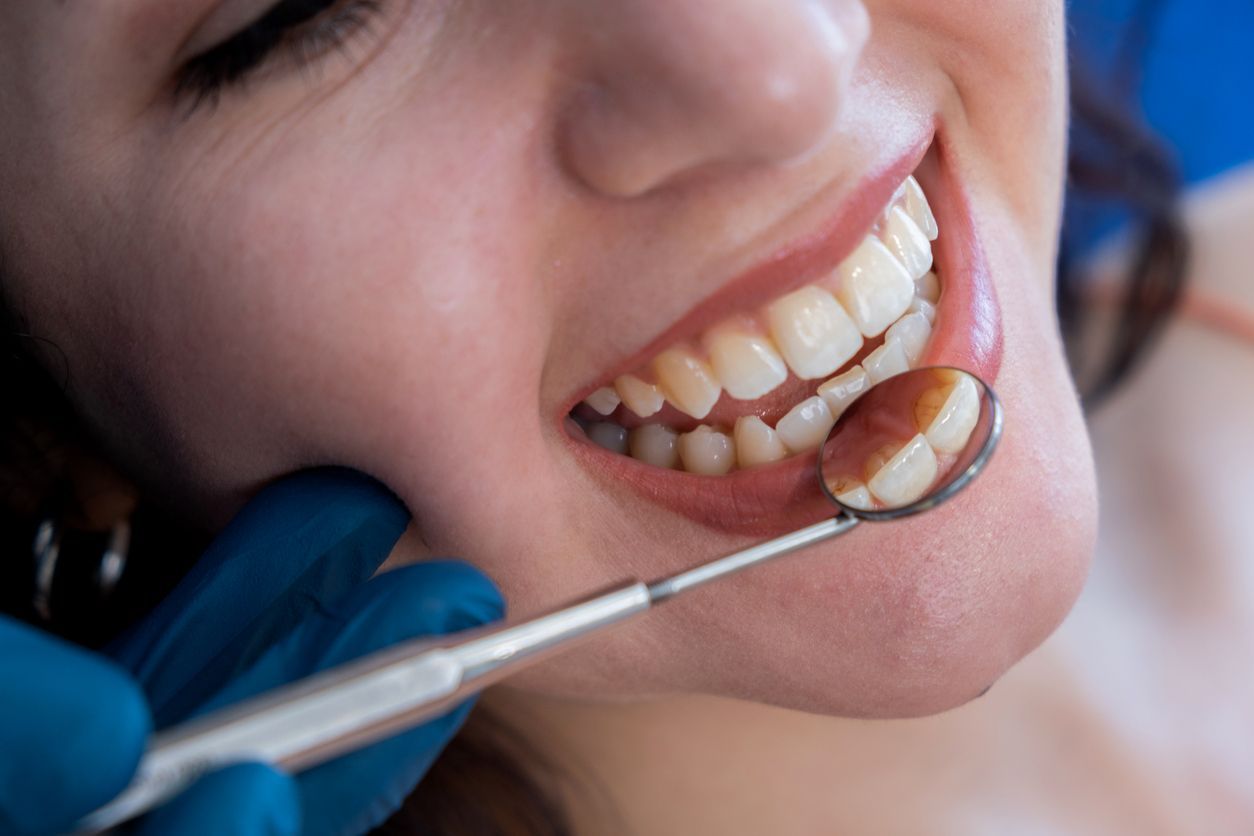 Dental Checkup