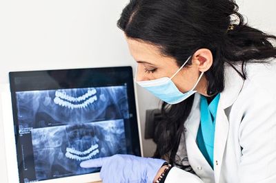 Dentist Pointing To An X-Ray - Denture Relines in Worth, IL