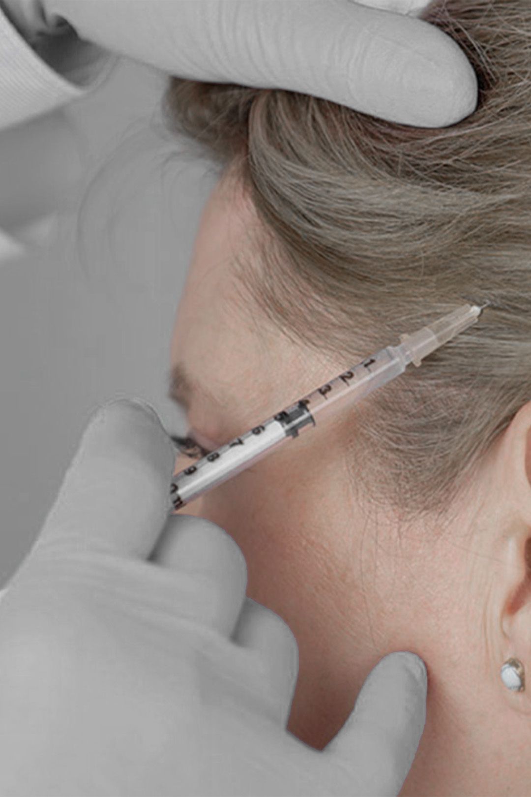 Person receiving an injection in the face near the ear; gloved hands holding a syringe.