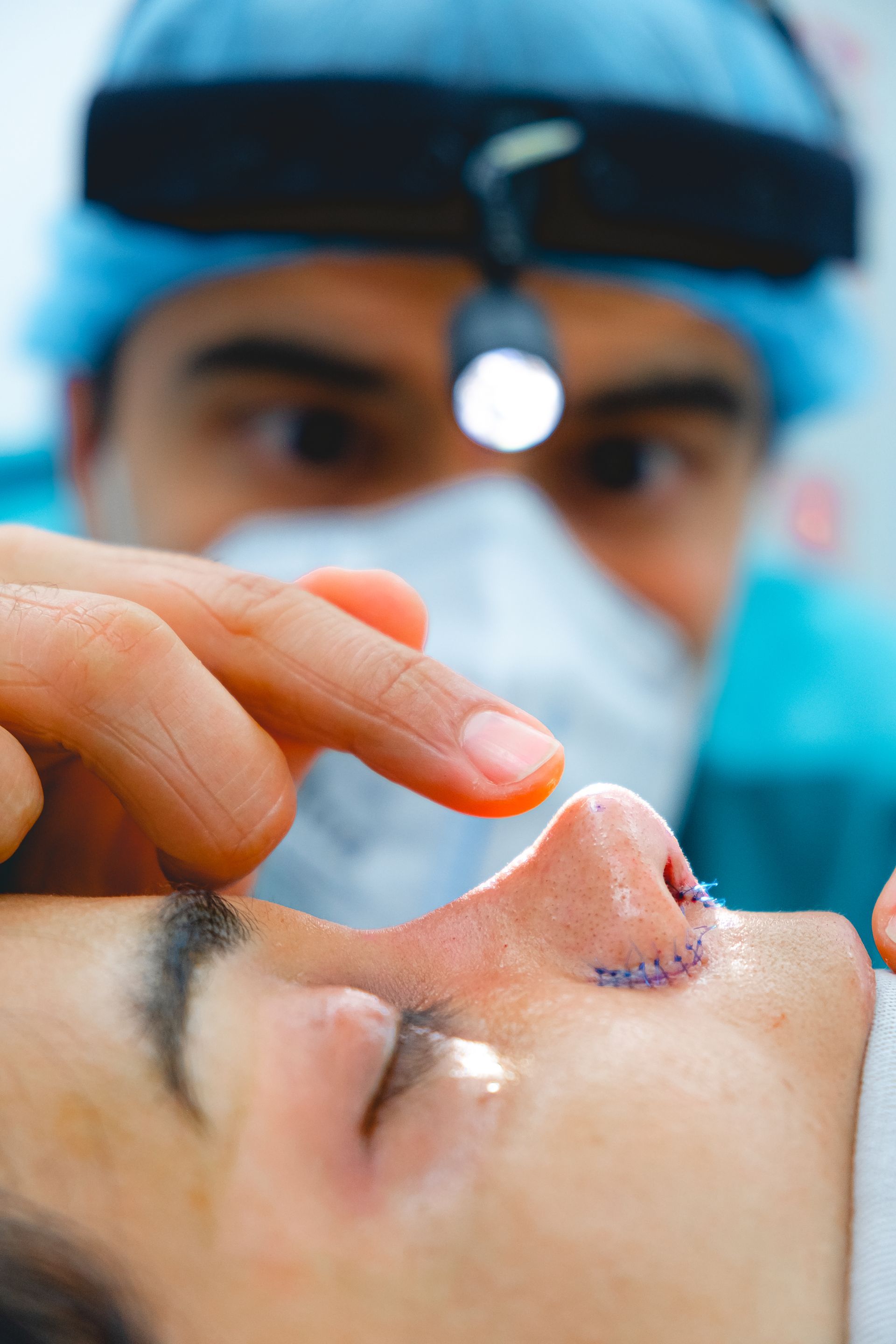 Rinoplastasin tapones