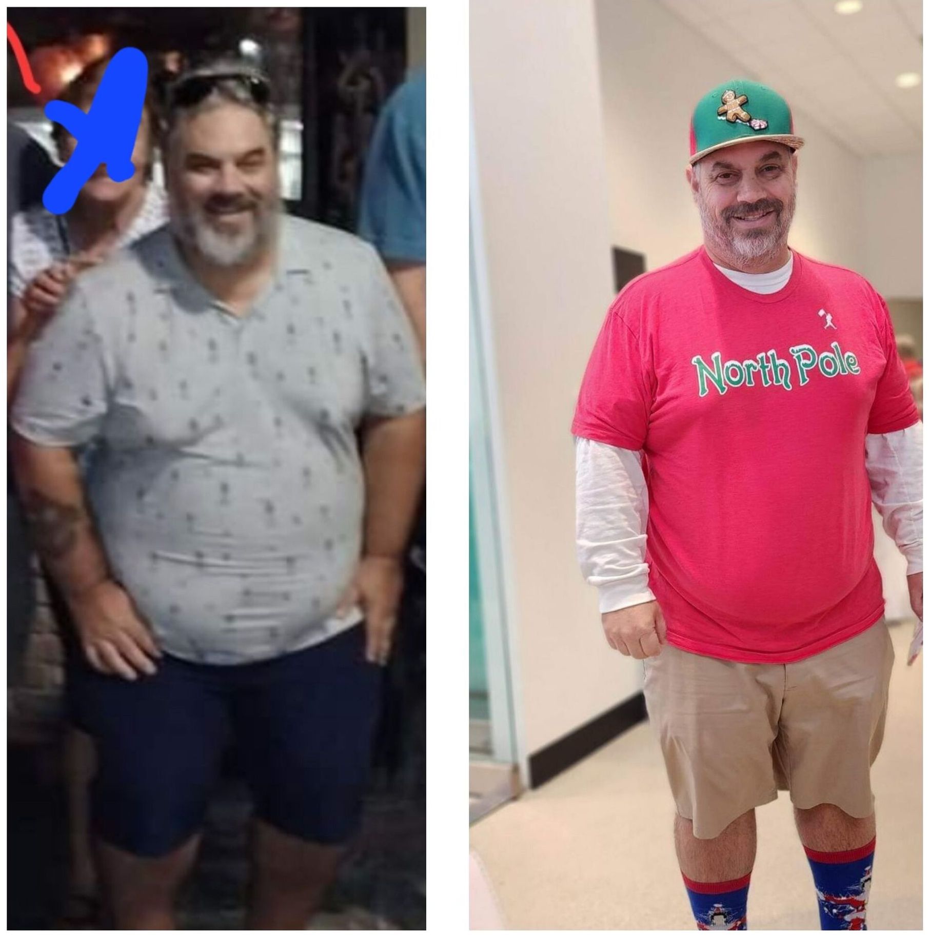 A before and after photo of a man wearing a north pole shirt