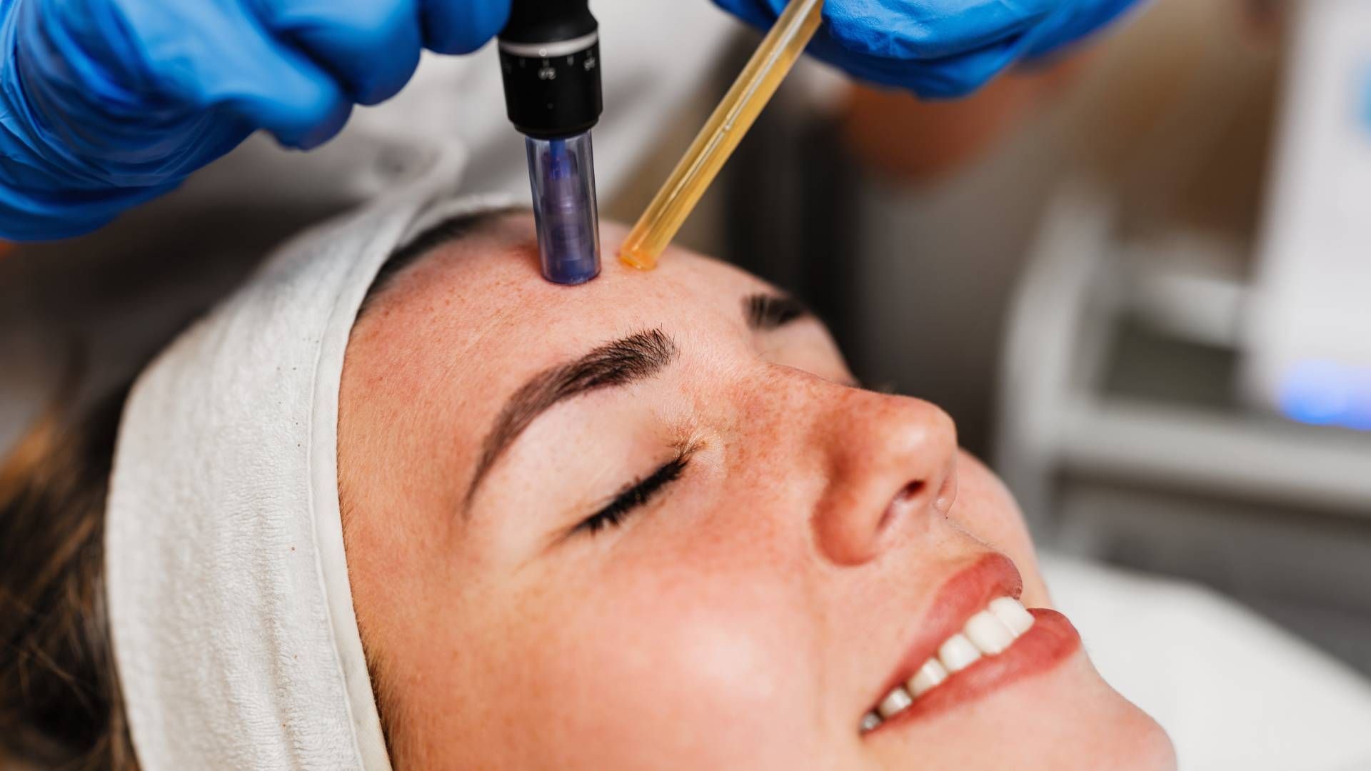 Woman receiving a micro-needling facial treatment; technician in blue gloves holds tool to forehead.