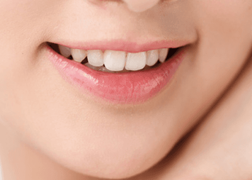 What are the symptoms of gum disease?