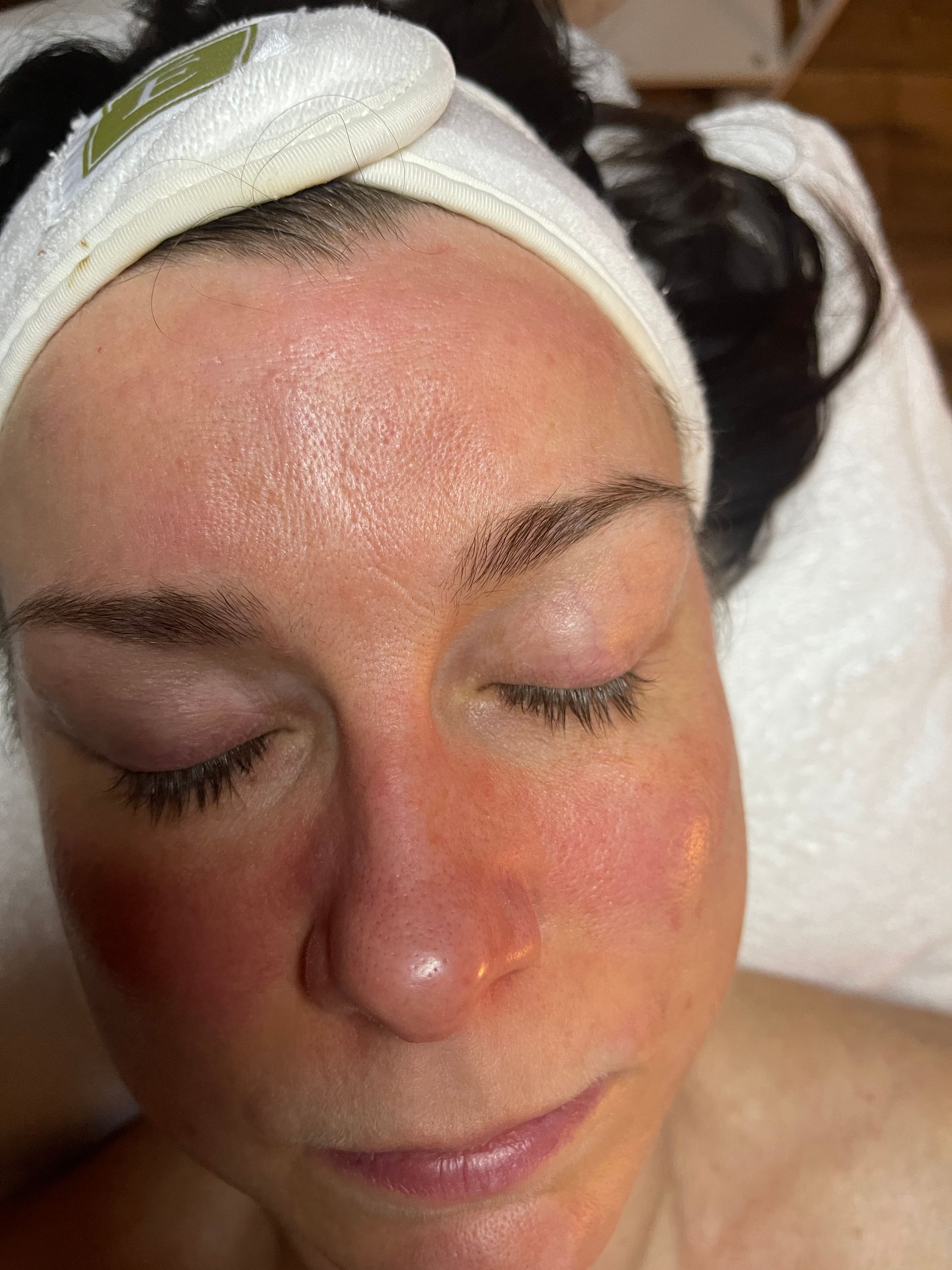 waxing treatment on face