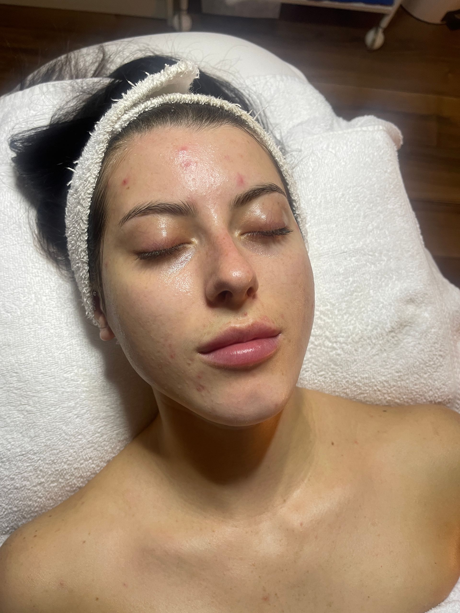 facial treatment