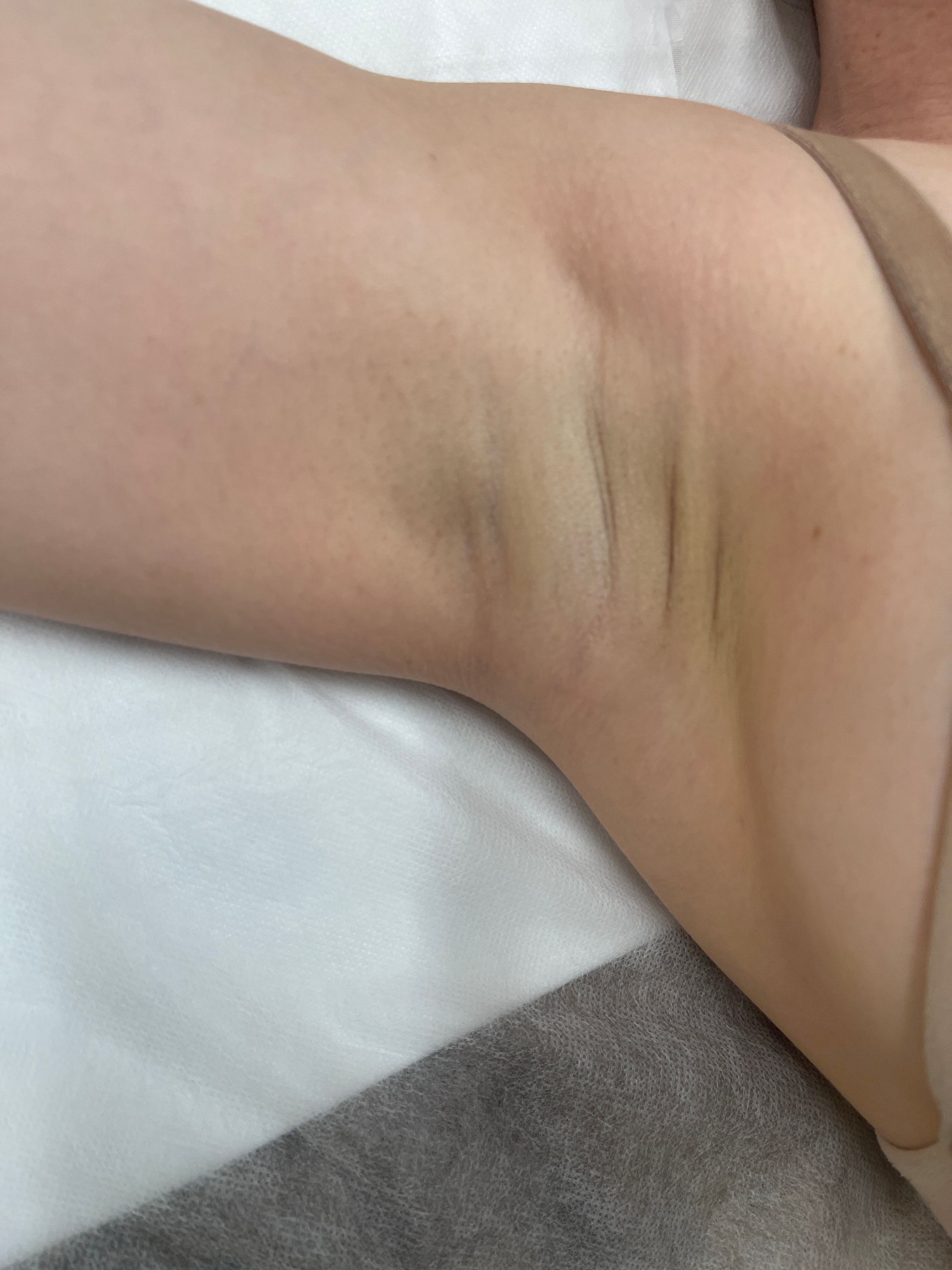 A close up of a person 's armpit on a bed.