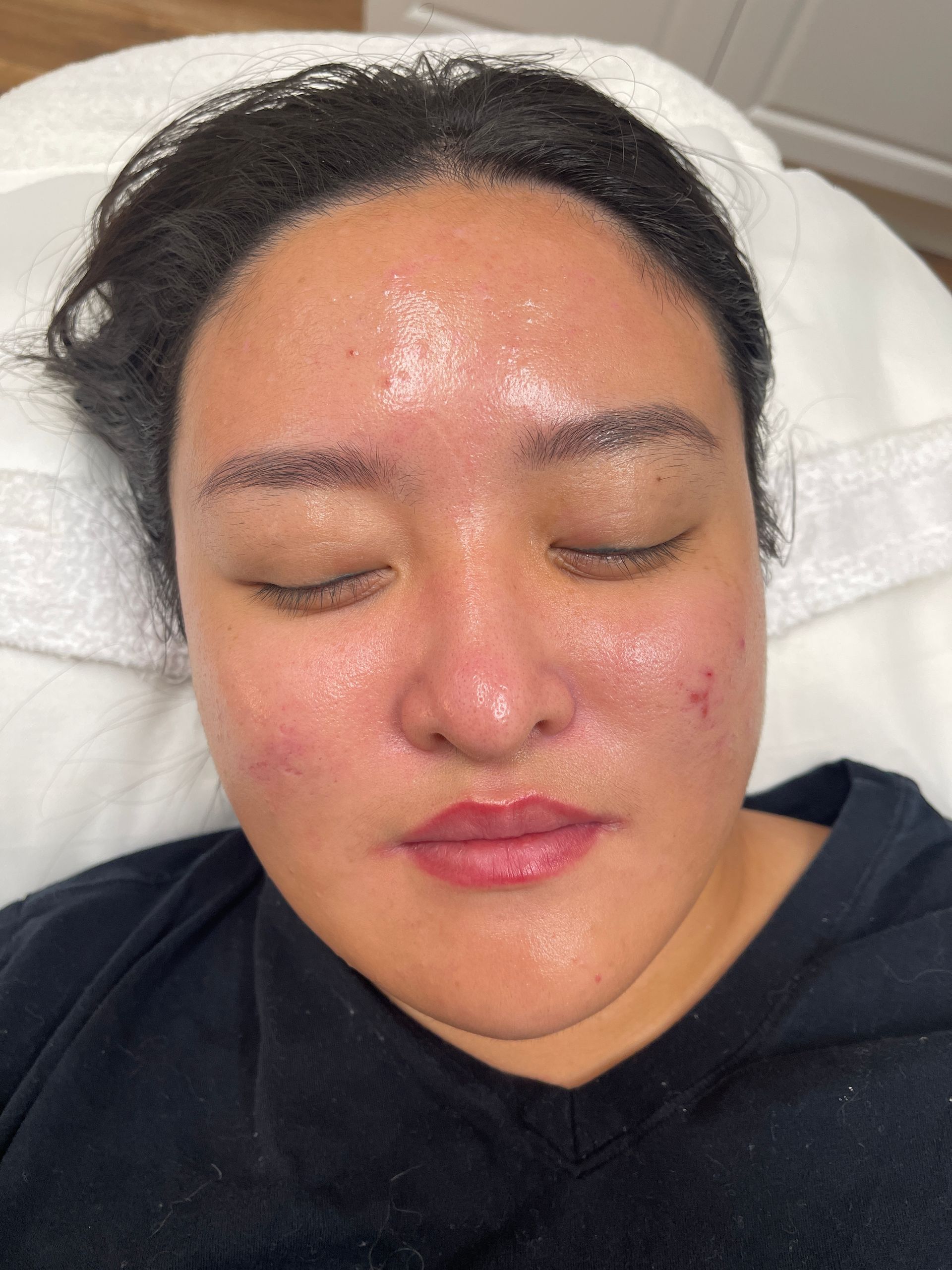 a woman with her eyes closed has a red spot on her face