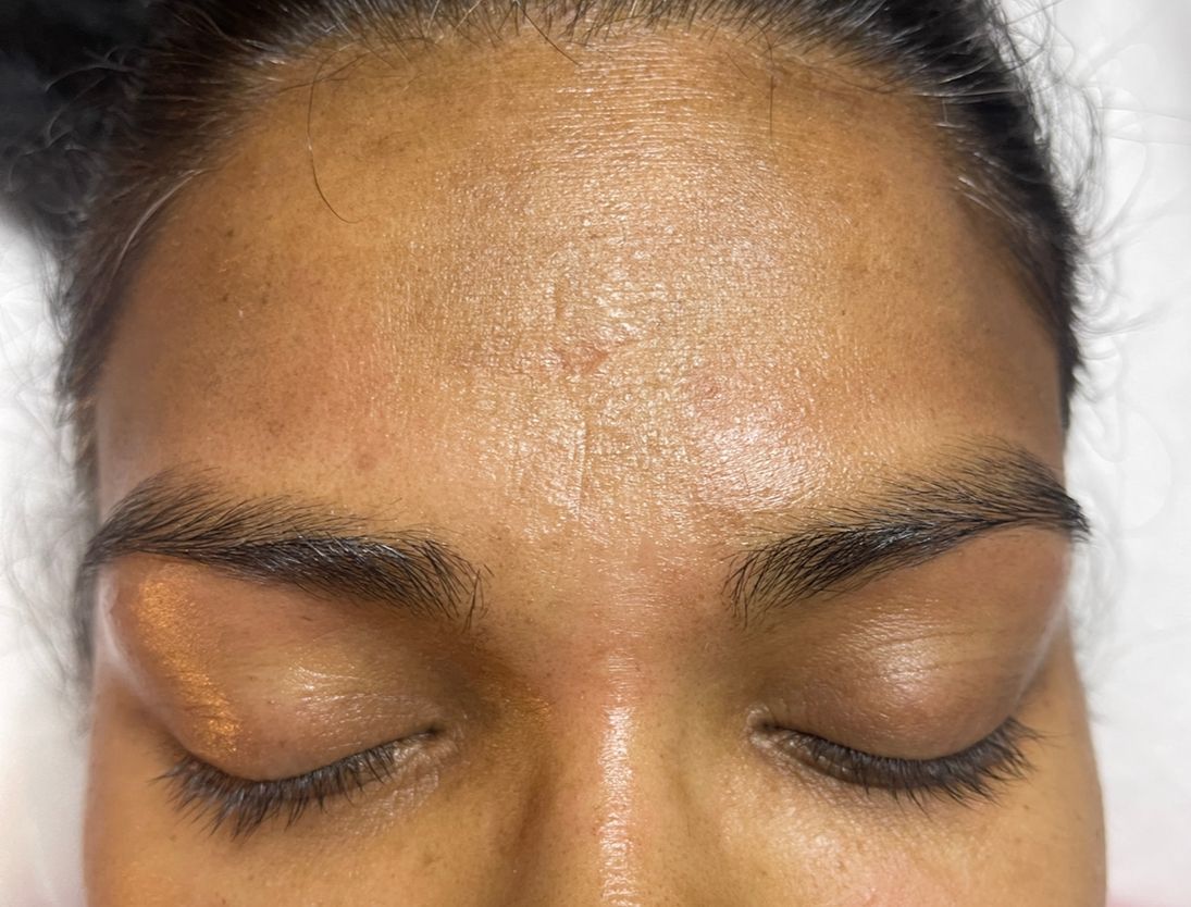 A close up of a woman 's forehead with her eyes closed.