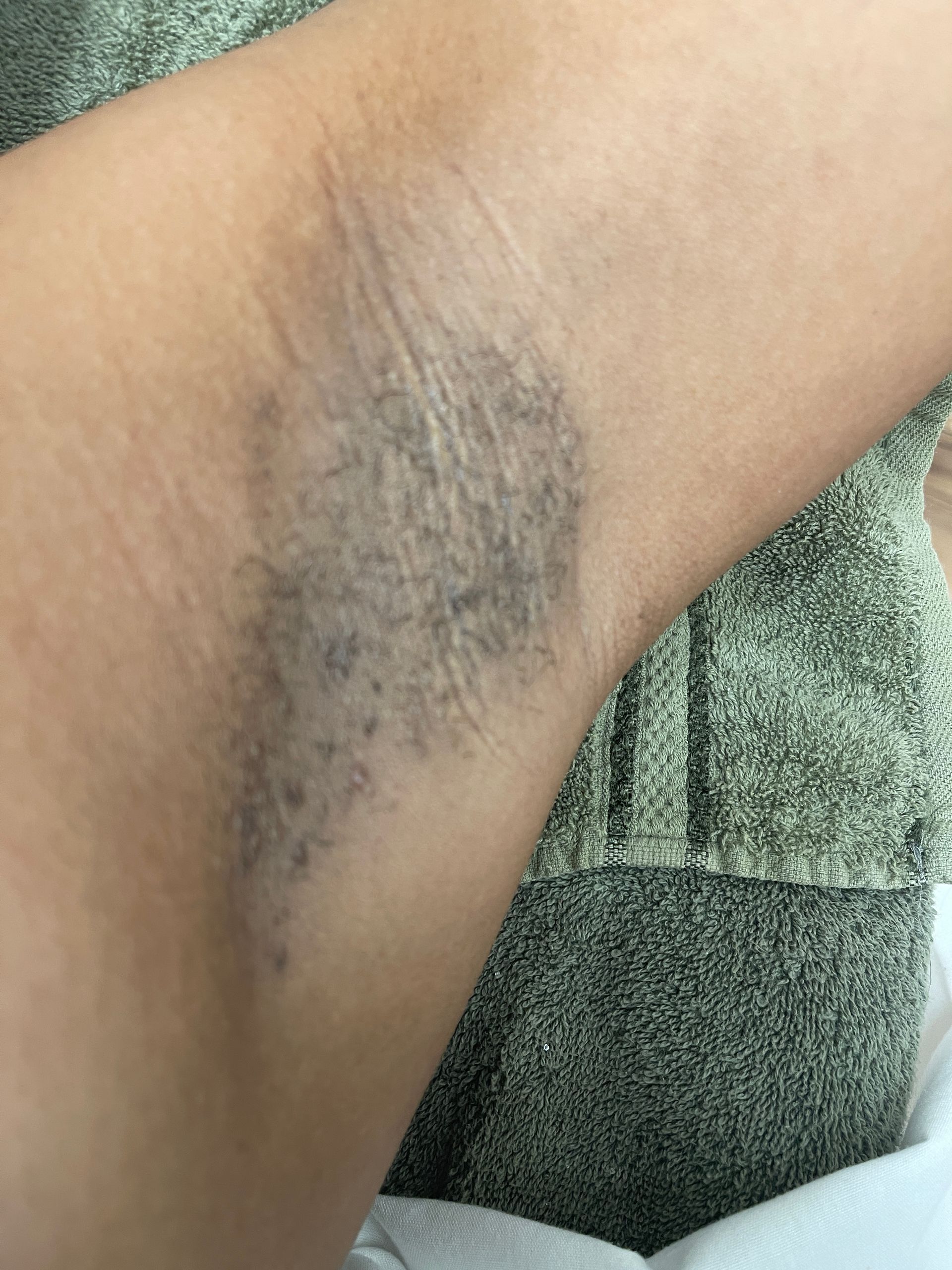 A close up of a person 's underarm with a tattoo on it.