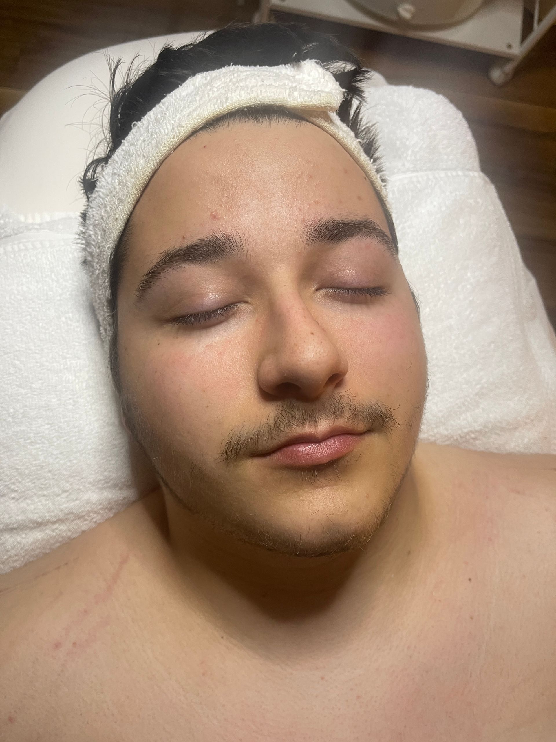 facial treatment