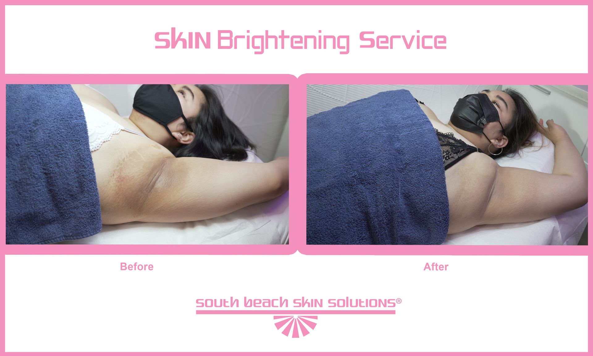 A before and after photo of a woman getting a skin brightening service