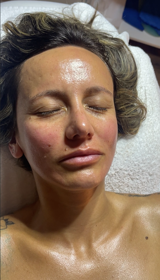 facial treatment