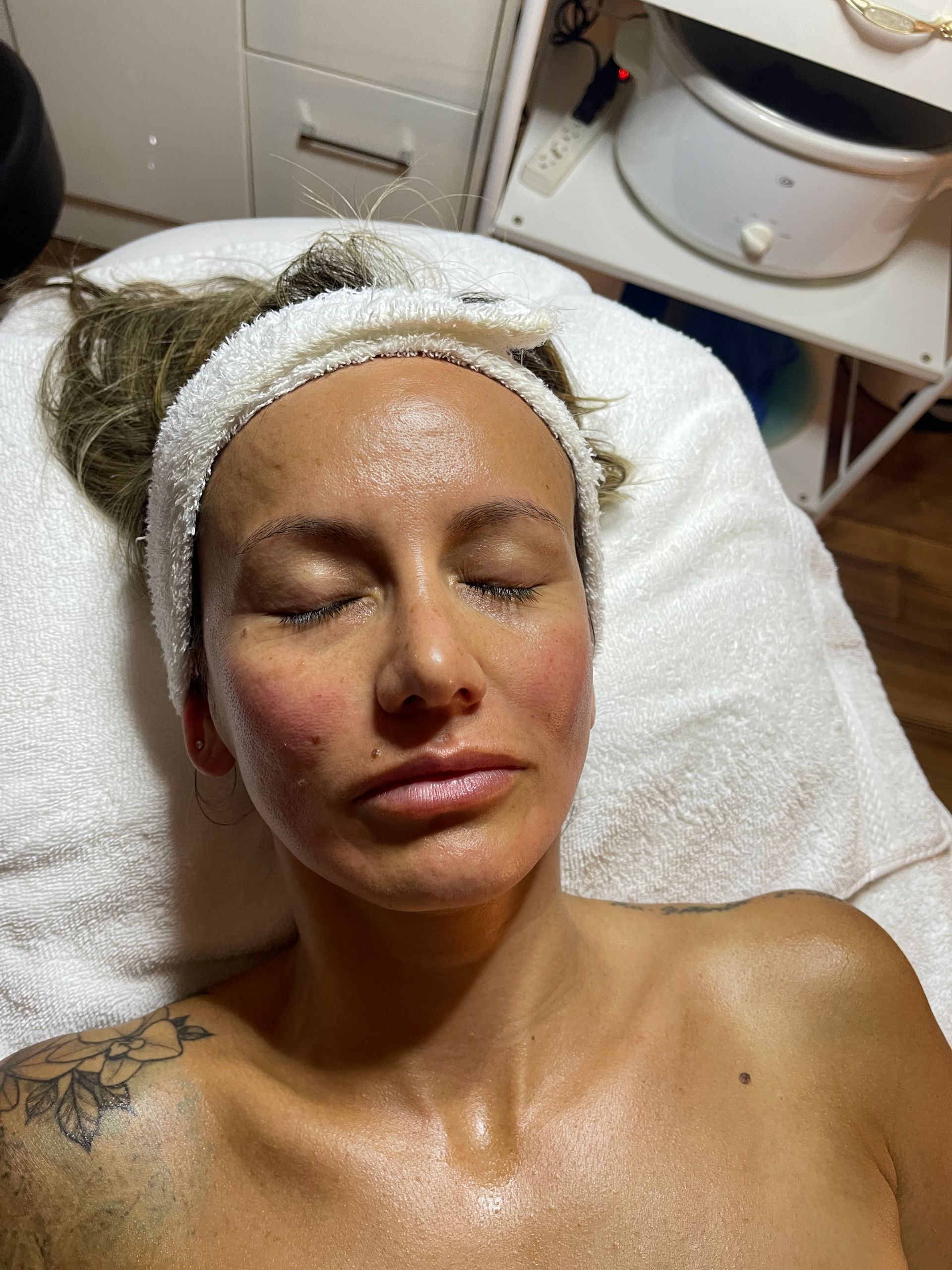 facial treatment