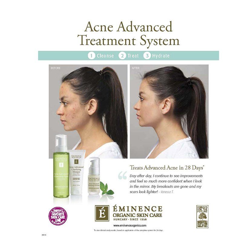 An advertisement for an acne advanced treatment system
