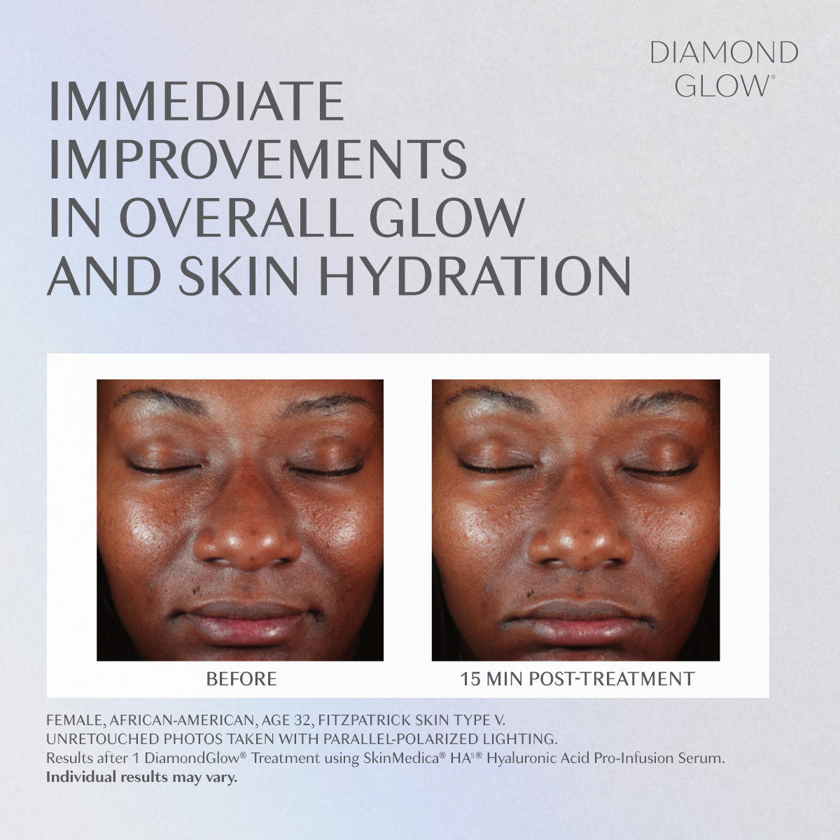 real patient before and after treatment with DiamondGlow