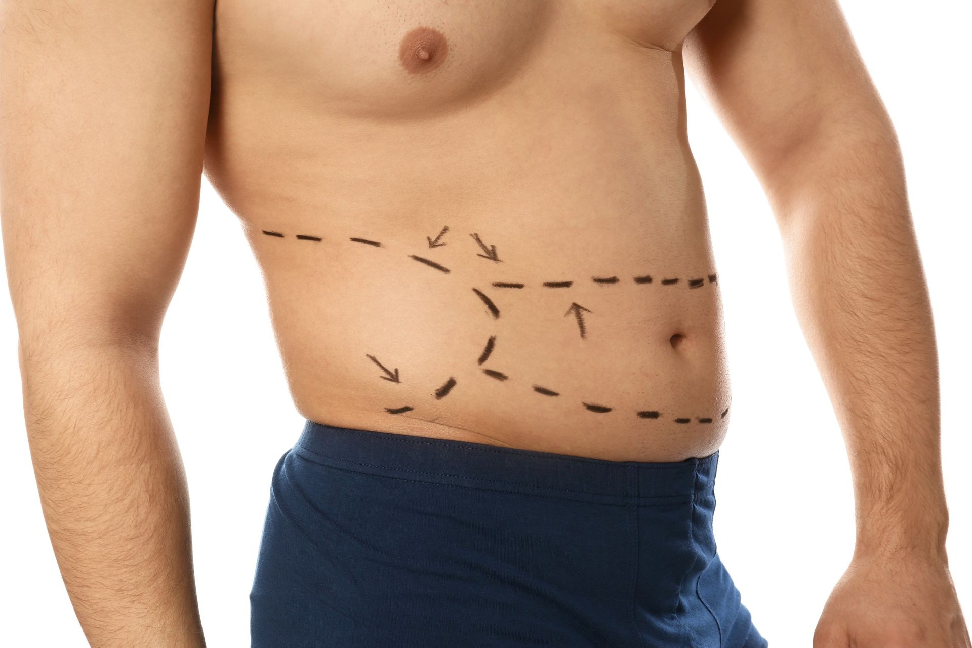 A shirtless man has lines drawn on his stomach