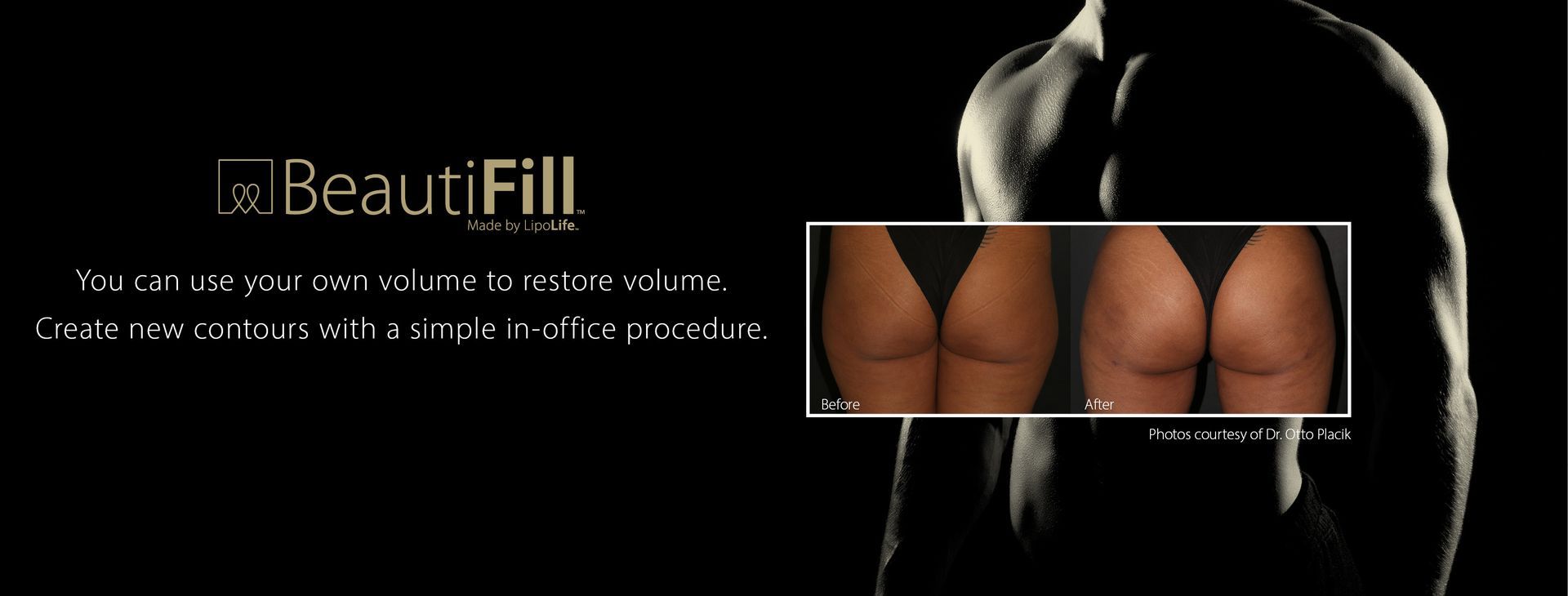 banner with black and white photo of man's muscled torso, with the BeautiFill logo and a before and after photo of a patient's buttocks