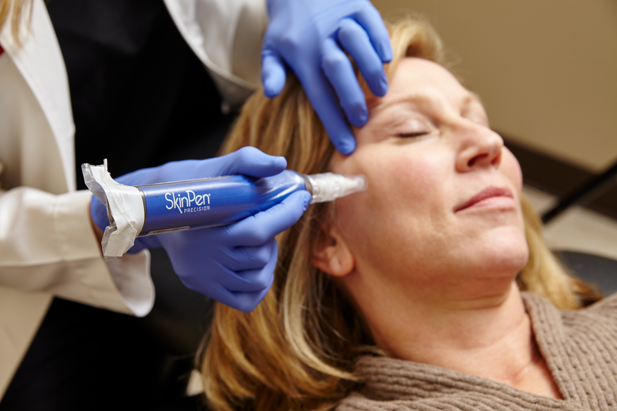 dermatologist demonstrating SkinPen treatment on real female patient in her 50s