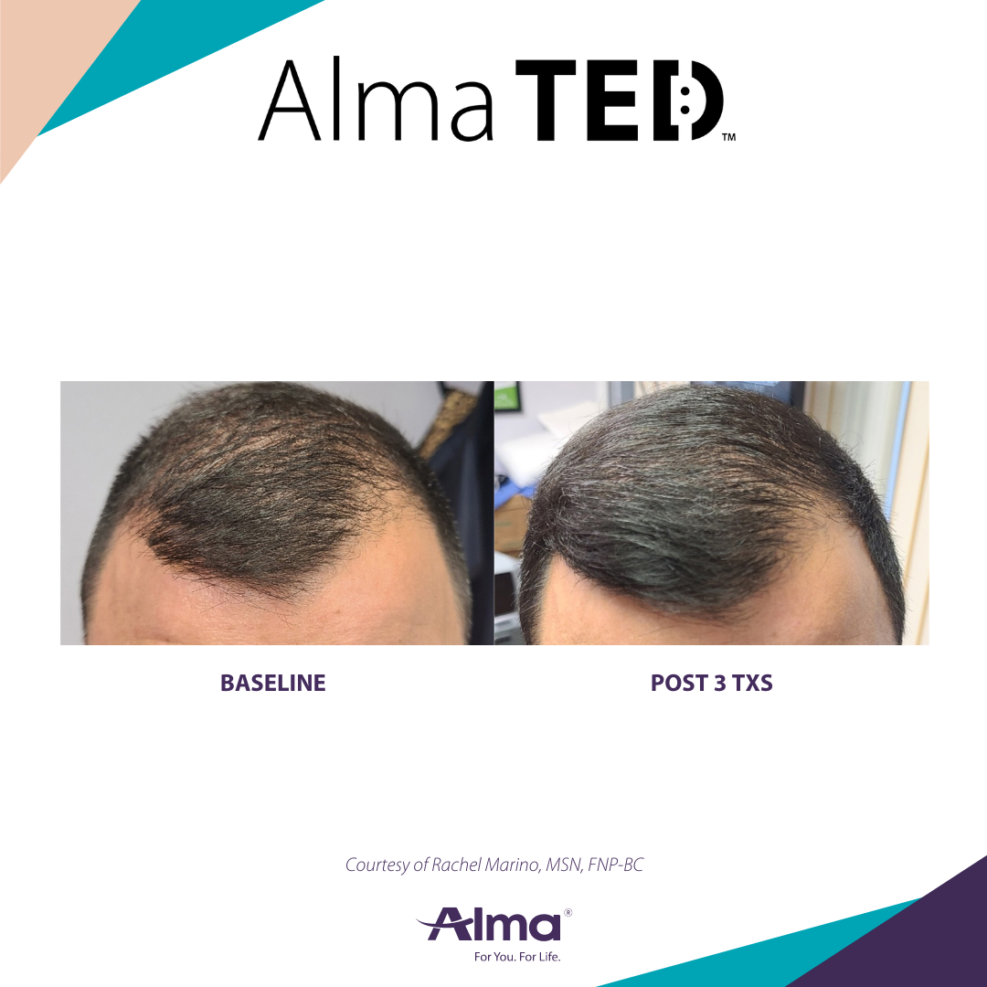 A before and after picture of a man 's hair