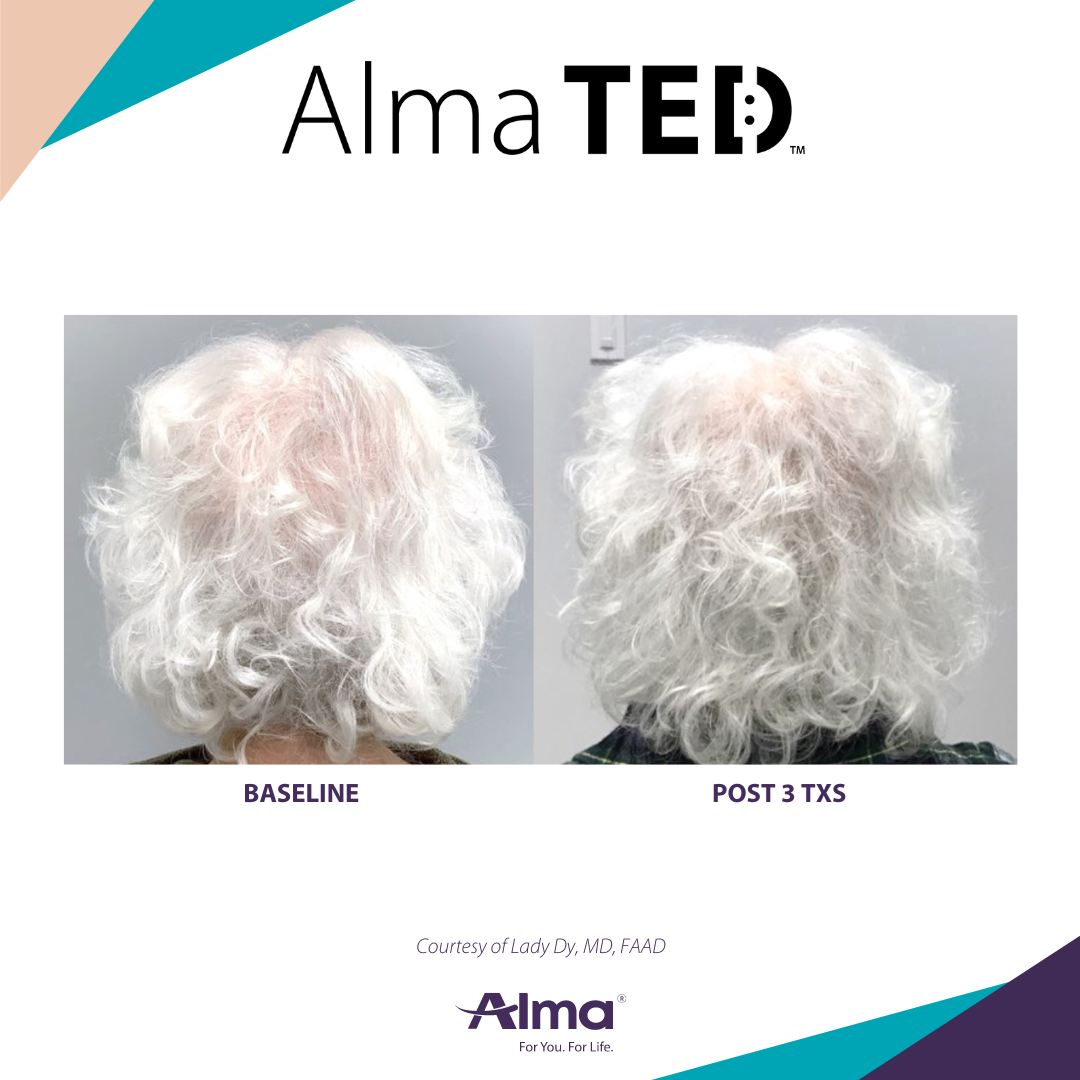 A before and after picture of a woman 's hair