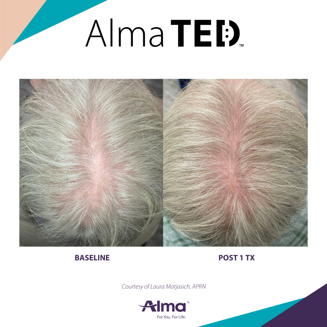 A before and after picture of a person 's hair