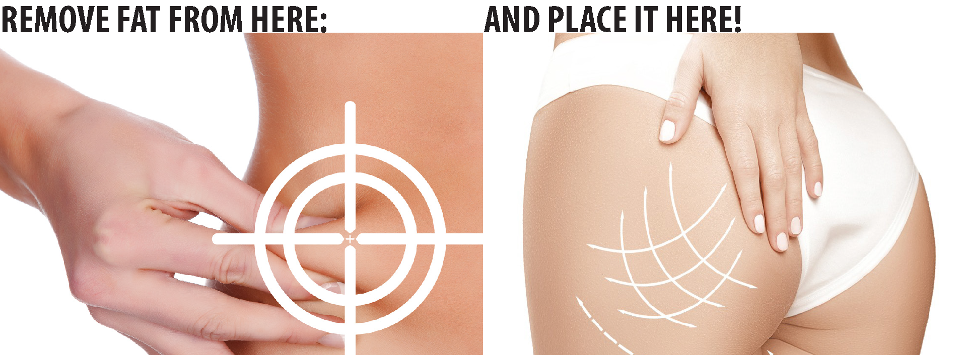 graphic showing body areas that can be target with BeautiFill