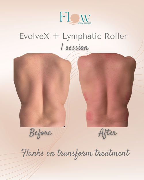 Upper back toning after one Evolve-X session and lymphatic roller at Flow Physique Chermside