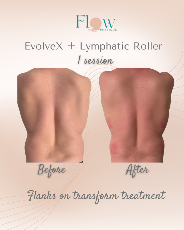 Upper back toning after one Evolve-X session and lymphatic roller at Flow Physique Chermside