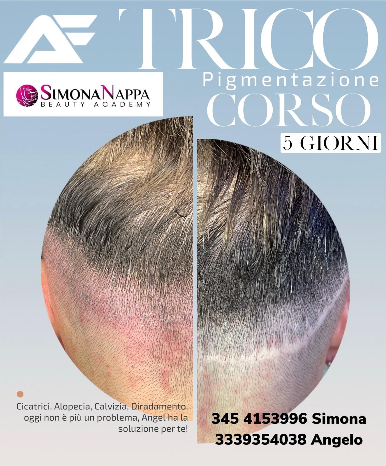 Una pubblicità per il corso di trico pigmentation mostra una foto prima e dopo