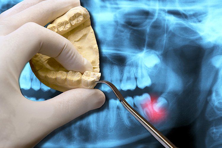 a dentist is examining a model of a person 's teeth