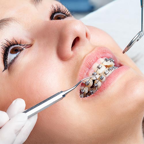 a woman with braces is getting her teeth examined by a dentist