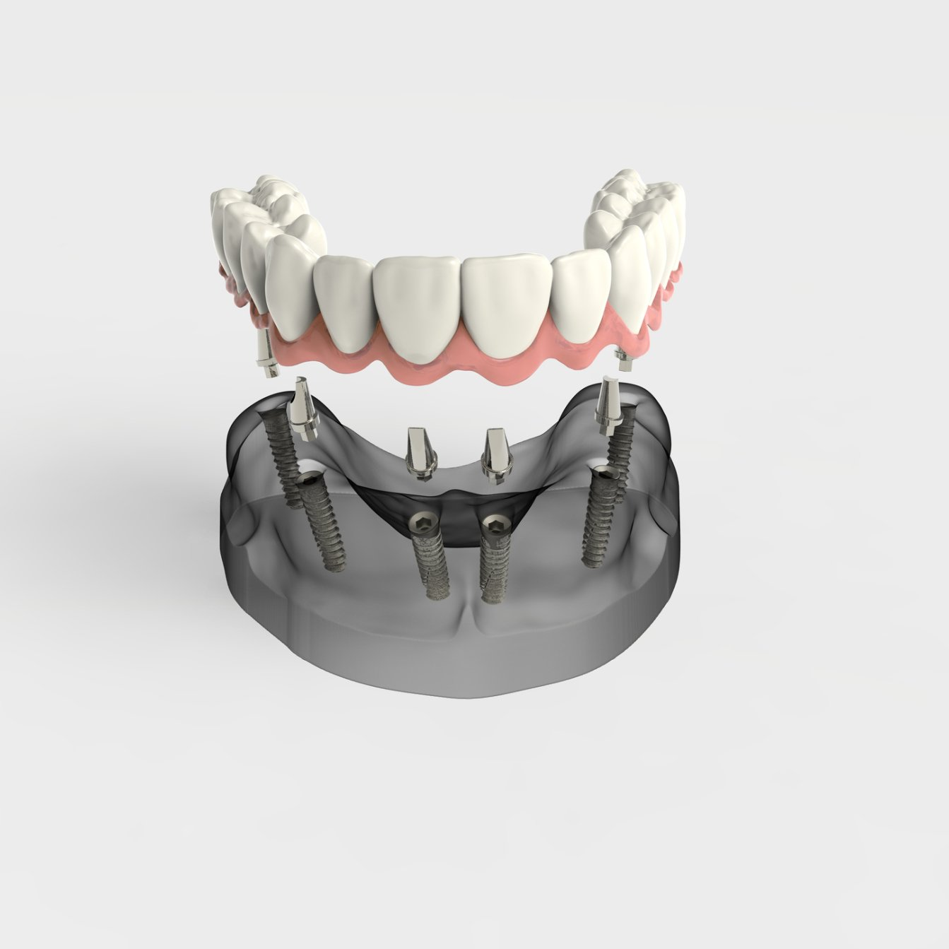 Image representing teeth restoration surgery in Cary, NC