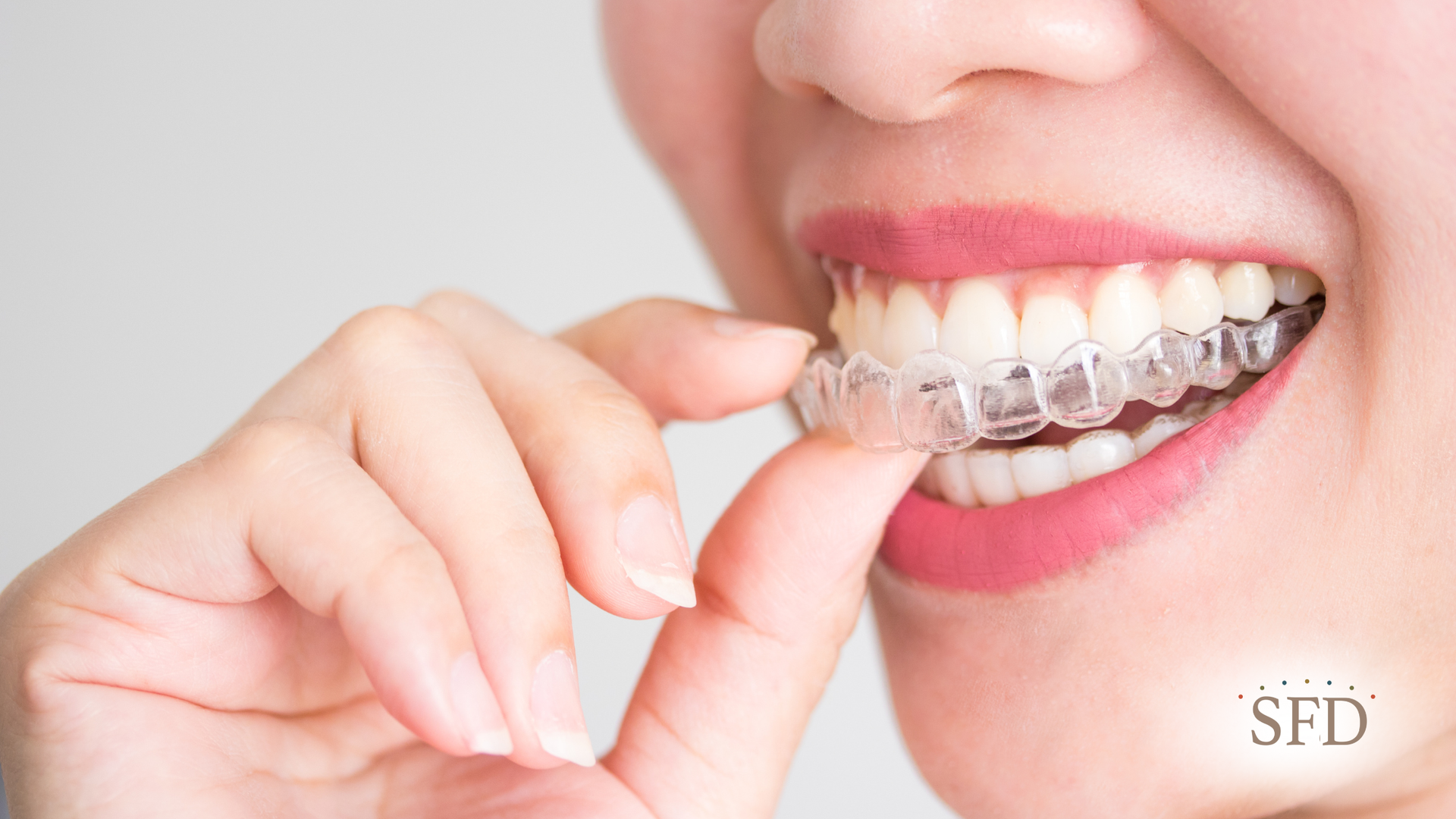 Person inserting clear aligner into mouth. Pink lipstick.